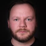 After cheek and tear trough filler, addressing signs of tiredness around the male eyes