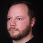 After cheek and tear trough filler, addressing signs of tiredness around the male eyes