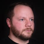 After cheek and tear trough filler, addressing signs of tiredness around the male eyes