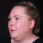 Before wrinkle-relaxing injections, addressing forehead lines.