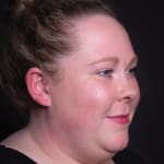 Before wrinkle-relaxing injections, addressing forehead lines.