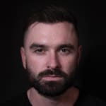 After wrinkle-relaxing injections, addressing forehead lines, frown lines, and crow's feet in a male patient.