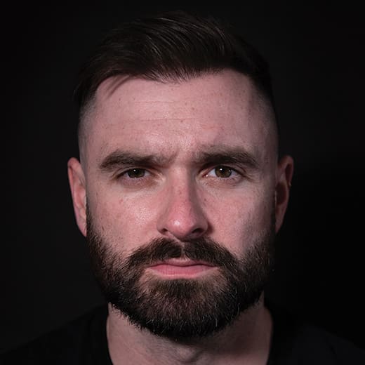 Before wrinkle-relaxing injections, addressing forehead lines, frown lines, and crow's feet in a male patient.