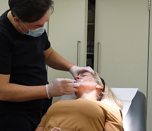 Acne treatment at McKeown Medical