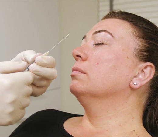 Filler being applied to patient