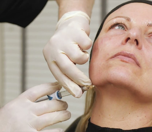 Jowls treatment being administered on patient