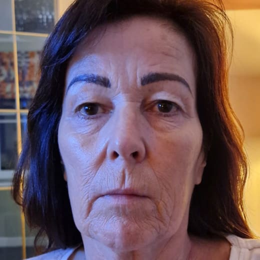 Before full facelift.