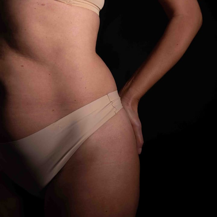 Close-up side view of a woman’s abdomen and hip showing toned, natural contours.