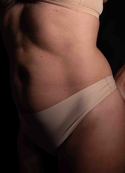 Close-up side view of a woman’s abdomen and hip showing toned, natural contours.